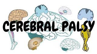 CEREBRAL PALSY  COMMON EXAM QUESTIONS  TEST YOUR MIGHT [upl. by Freddi]