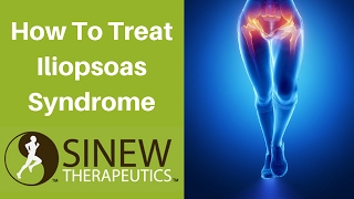 How To Treat Iliopsoas Syndrome and Speed Recovery [upl. by Aliuqehs]