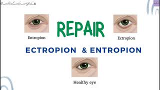 REPAIR ECTROPION amp ENTROPION CPT TOPICS MEDICAL CODING AND BILLING medicalcodercertified [upl. by Elie]