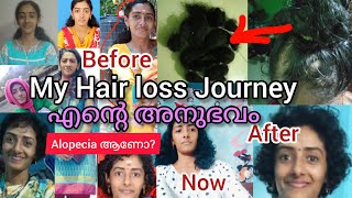 My Hair Loss Journey  എൻ്റെ സ്വന്തം അനുഭവം ഞാൻ പങ്കുവയ്ക്കുന്നു  Alopecia ആണോ Malayalam [upl. by Gilson]