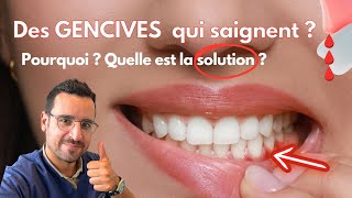 Explication GENCIVE qui SAIGNE  la solution [upl. by Hu440]