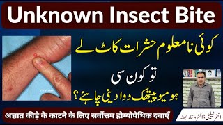 Insects Bite unknown نامعلوم حشرات کا کاٹنا अज्ञात कीट का काटना Homeopathic Treatment In Urdu Hindi [upl. by Noy]