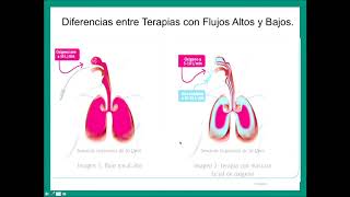 Consideraciones de la Cánula Nasal de Alto Flujo en Paciente COVID19 [upl. by Ayotahc]