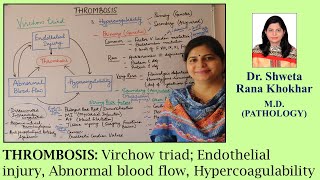 THROMBOSIS Virchow triad Endothelial injury Abnormal blood flow Hypercoagulability [upl. by Angele]