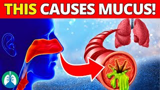 Top 10 Diseases That Cause Mucus  MUST Avoid for Respiratory Health [upl. by Oeak214]