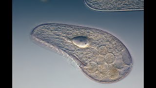 Microbiology of Eukaryotes Protozoa [upl. by Dazhehs322]