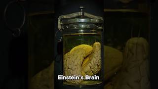 Whats wrong with Einstein brain einstein brain [upl. by Benji472]