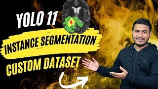 YOLO11 Instance Segmentation on Custom Dataset [upl. by Ebeneser512]