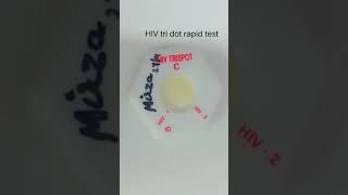 Hiv🩸🩸 Short hiv rapid test [upl. by Civ504]