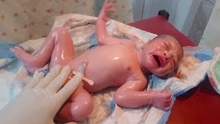 New born baby came with lot of vernix cleaning done with baby oil removed vernix💞❣️ [upl. by Carissa]