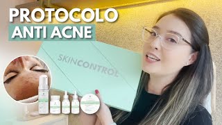 PROTOCOLO ANTI ACNE  SKINCONTROL ELLEMENTTI [upl. by Henrik]