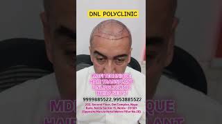 polyclinic haircare transformation hair noida treatment [upl. by Anek]