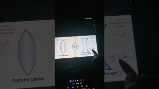 Concave vs convex lens opthalmology [upl. by Asik]