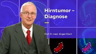 Hirntumor – Diagnose [upl. by Ahsitil]