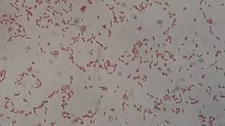 Gram Negative Rods of Citrobacter farmeri in Gram Staining of Culture Microscopy at various mag [upl. by Daas]