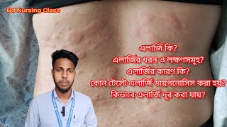 এলার্জি থেকে মুক্তি Allergy prevention [upl. by Llednil]