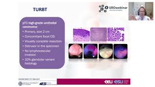 Urowebinar BCG unresponsive disease how this definition impact your treatment decision making [upl. by Novyad617]