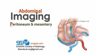 14 Imaging of peritonium and mesentery TEC Prof Mamdouh Mahfouz [upl. by Lynad]