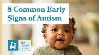 8 Common Early Signs of Autism [upl. by Ergener]