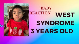 infantile spasms baby infantile spasms baby video west syndrome seizure west syndrome kya hota h [upl. by Poree]