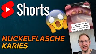 Nuckelflaschenkaries 2 shorts [upl. by Apicella]