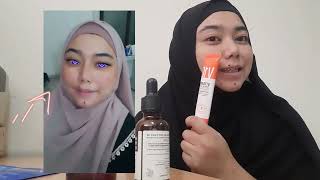 REVIEW SOME BY MI GALACTOMYCES PURE VITAMIN C NGILANGIN FLEK HITAM [upl. by Aerdnaid]