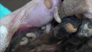 Parasitic infestation  Human Myiasis diabetic foot [upl. by Nnylkcaj]