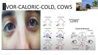 Estudio de la mirada Analisis clinico de movilidad ocular multidireccional [upl. by Alue746]