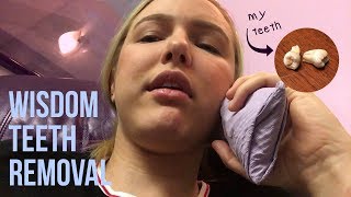 Wisdom Teeth Removal  My Experience [upl. by Eimma149]