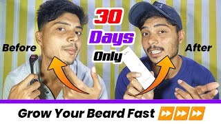 How To Use Derma Roller For Beard Growth Fast🧔⏩  Beard Growth Tips 2023  Mars Derma Roller Review [upl. by Bak]