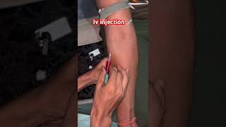 Iv injection viralvideo li [upl. by Argyres]