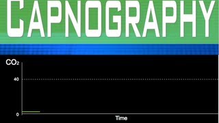 EtCO2 Capnography Part 4 [upl. by Leanatan]