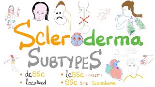 Scleroderma Subtypes 5 Types of Systemic Sclerosis incl Limited vs Diffuse Scleroderma [upl. by Cassy]