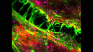 ZEISS LSM 880 HeLa cells with Airyscan [upl. by Carol]