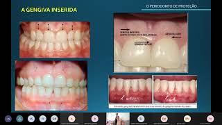 ODONTO MORFOFUNCIONAL 20212 150921  ANATOMIA E HISTOLOGIA DO PERIODONTO PARTEII [upl. by Raseda]