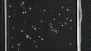 Cholesterol Regulates Monocyte Rolling through CD44 Distribution [upl. by Reinhardt]