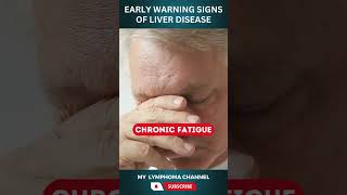 Early Warning Signs of Liver Disease [upl. by Iv434]