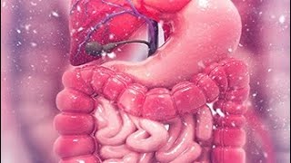 Intestinal obstruction part 2 and Benign tumor of intestine [upl. by Eleanora]