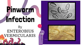 Pinworm Infection Causes and Treatment  Life Cycle of Pinworm Intestinal nematodes Novice Medic [upl. by Favrot]