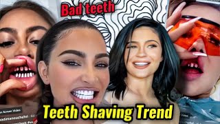 KYLIE JENNER amp KIM KARDASHIANS VENEERS GONE WRONG TURKEY TEETH WEIRD TREND [upl. by Win312]