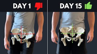 The Best Resource On The Internet For Fixing Lateral Pelvic Tilt asymmetrical hips [upl. by Tahpos]