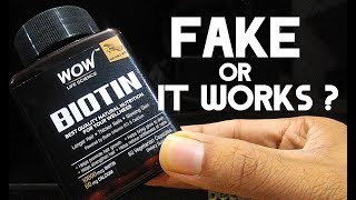 WOW BIOTIN Honest Review After Use  क्या यह काम करता है [upl. by Aicnelev950]