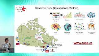 8th BigBrain Workshop 2024 The McGill multimodal data ecosystem [upl. by Parsaye465]