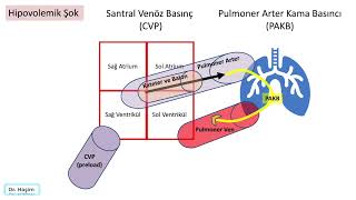 CVP santral venöz basınç ve PAKB pulmoner arter kama basıncı [upl. by Anem738]