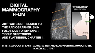 THE ARTIFACTS CORRELATED TO THE RADIOGRAPHER IN DIGITAL MAMMOGRAPHY SKIN FOLDS VIDEO 2 [upl. by Elene753]