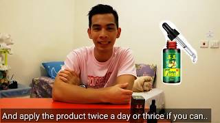 7 Days Ginger Germinal Oil  Hair Fall Topic [upl. by Faden]