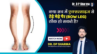 Can Bow Legs Be Corrected With Exercises Bow Legs Correction In Delhi NCR amp Agra  Dr DP Sharma [upl. by Harlie736]