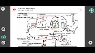 hemochromatosis [upl. by Neirol783]