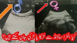 Ultra sound se kesy dekhy k ladka he ya ladki  How to know baby boy or girl in altra sound reports [upl. by Onit303]