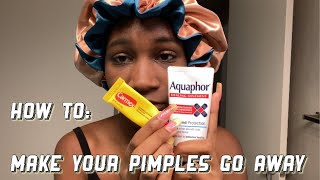 How To Get Rid Of Pimples With Carmex And Aquaphor [upl. by Arem]